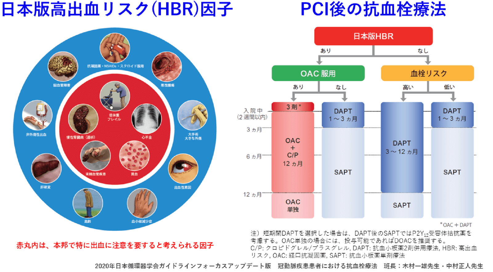 高出血リスク（HBR）とPCI後の抗血栓療法の推奨