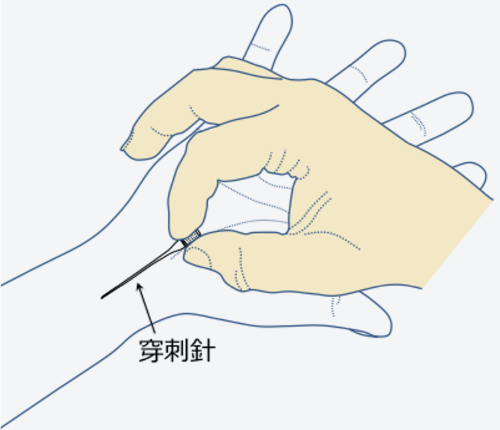 消毒と麻酔